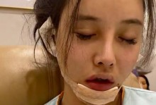 从网红整容事件看游戏行业的造型设计（以恋与制作人为例，探讨网红整容事件在游戏制作中的影响与启示）
